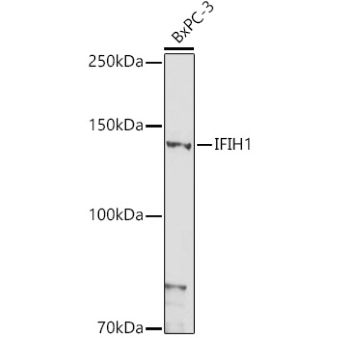 IFIH1 Rabbit Polyclonal Antibody