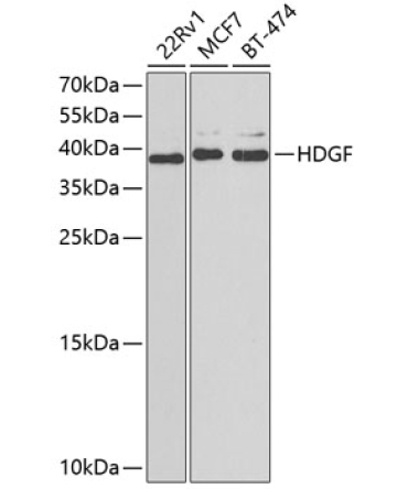 HDGF Rabbit Polyclonal Antibody