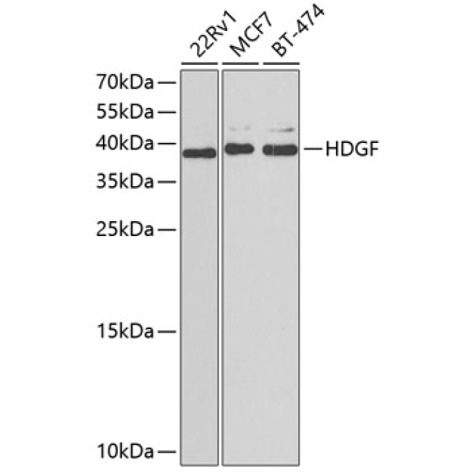 HDGF Rabbit Polyclonal Antibody