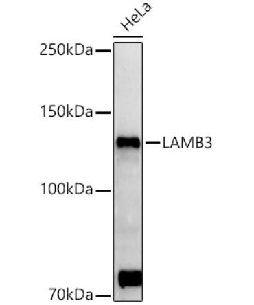 LAMB3 Rabbit Polyclonal Antibody