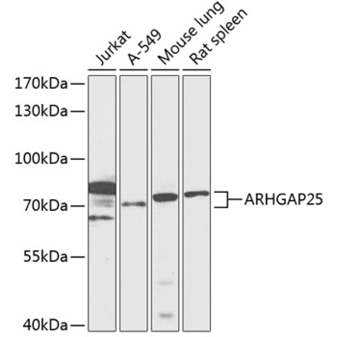 ARHGAP25 Rabbit Polyclonal Antibody