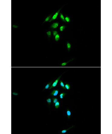 Glucocorticoid Receptor Rabbit Polyclonal Antibody