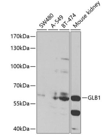 GLB1 Rabbit Polyclonal Antibody