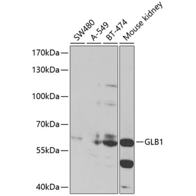 GLB1 Rabbit Polyclonal Antibody