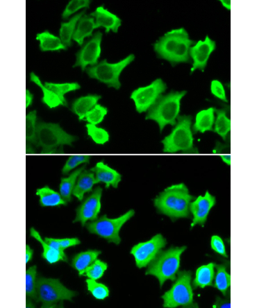 HSP27/HSPB1 Rabbit Polyclonal Antibody
