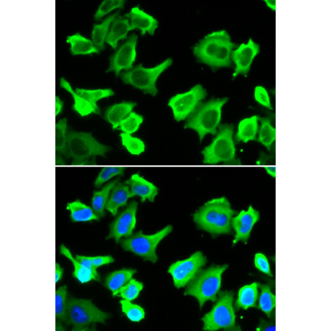 HSP27/HSPB1 Rabbit Polyclonal Antibody