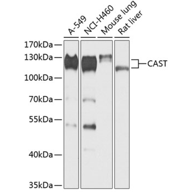 CAST Rabbit Polyclonal Antibody
