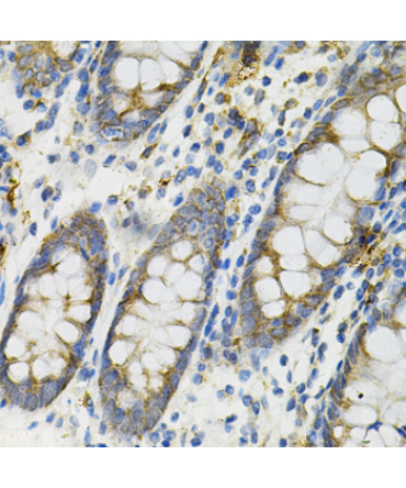 DEFB132 Rabbit Polyclonal Antibody