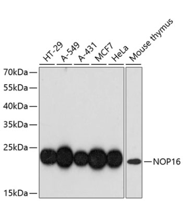 NOP16 Rabbit Polyclonal Antibody
