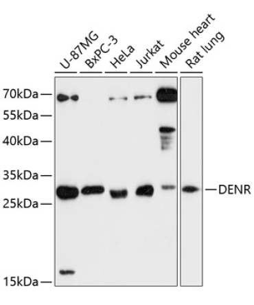 DENR Rabbit Polyclonal Antibody