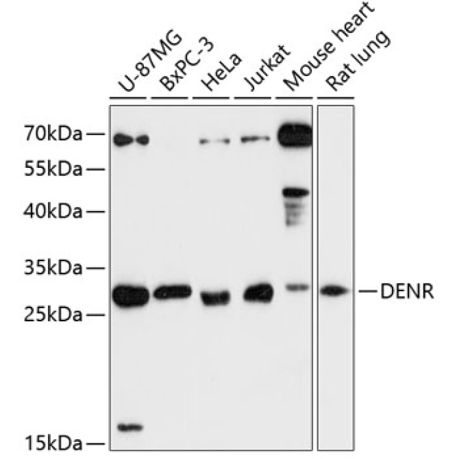 DENR Rabbit Polyclonal Antibody