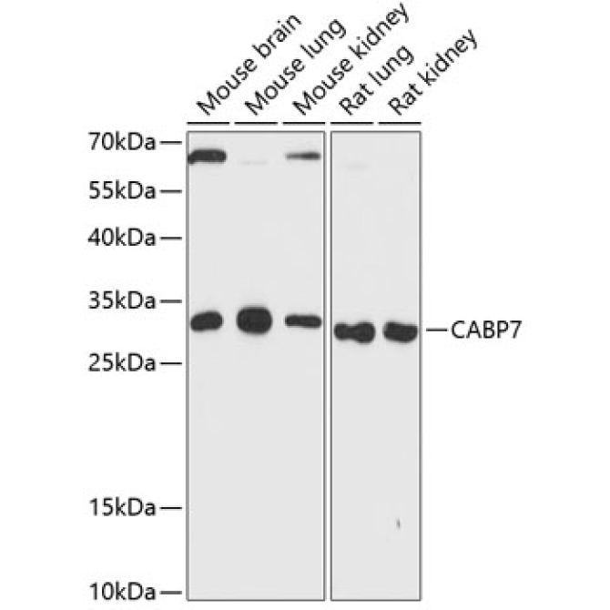CABP7 Rabbit Polyclonal Antibody