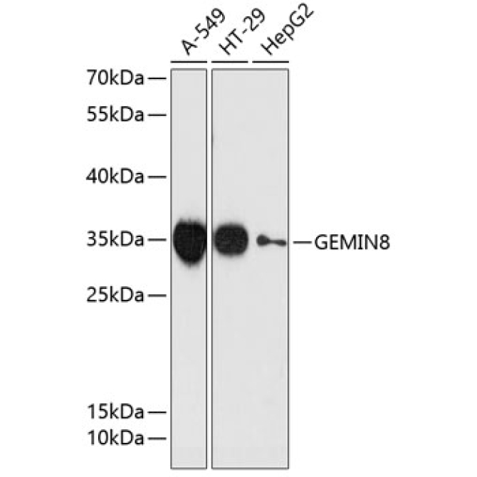 GEMIN8 Rabbit Polyclonal Antibody