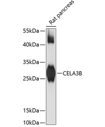 CELA3B Rabbit Polyclonal Antibody