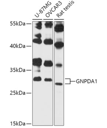 GNPDA1 Rabbit Polyclonal Antibody