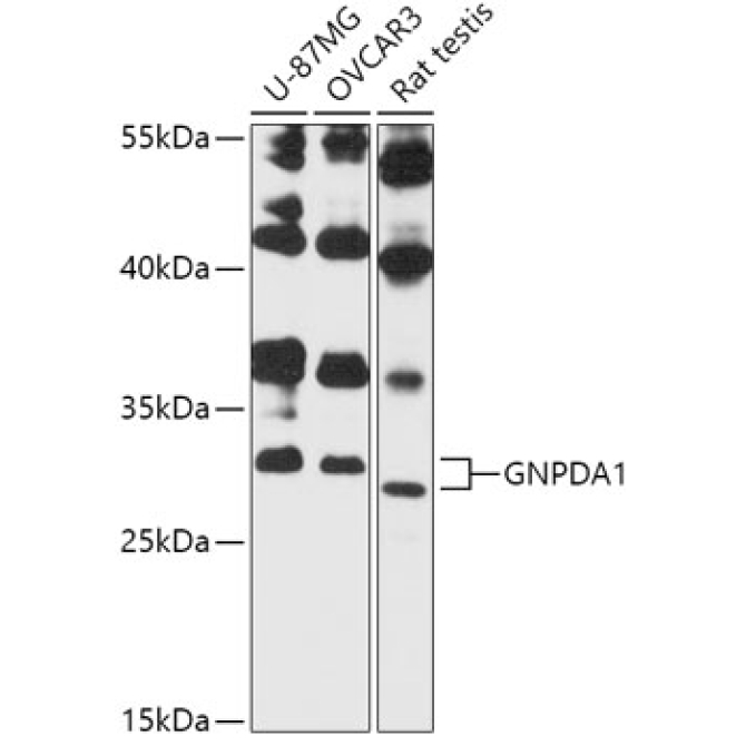 GNPDA1 Rabbit Polyclonal Antibody