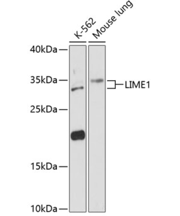 LIME1 Rabbit Polyclonal Antibody