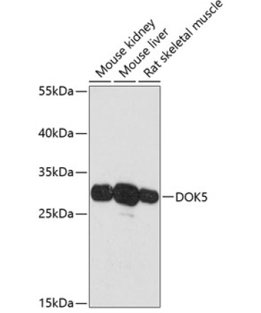 DOK5 Rabbit Polyclonal Antibody