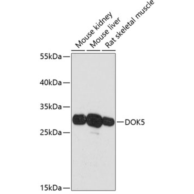 DOK5 Rabbit Polyclonal Antibody