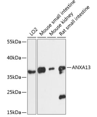 ANXA13 Rabbit Polyclonal Antibody