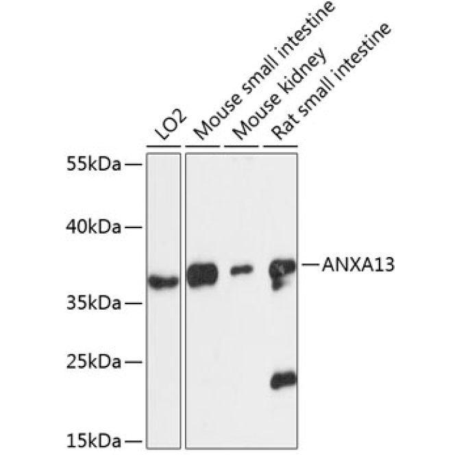 ANXA13 Rabbit Polyclonal Antibody