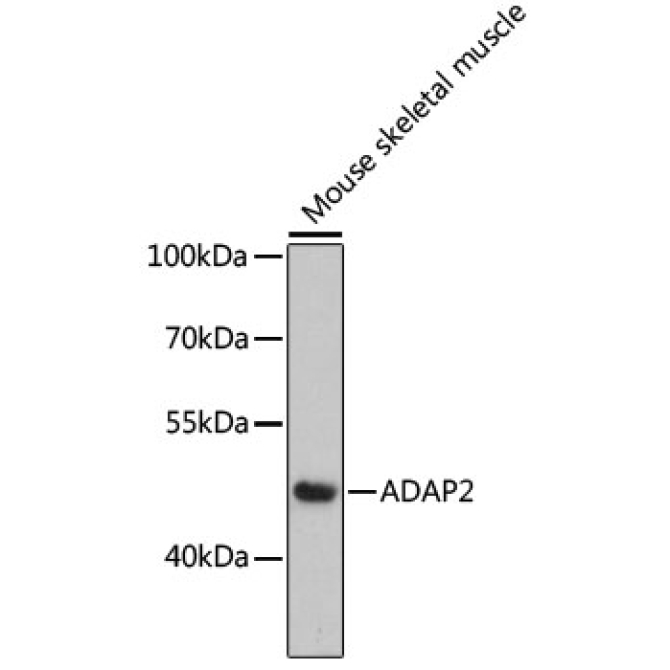 ADAP2 Rabbit Polyclonal Antibody