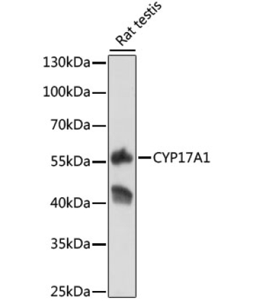 CYP17A1 Rabbit Polyclonal Antibody