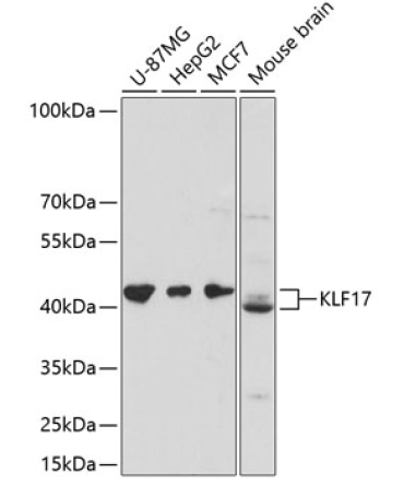 KLF17 Rabbit Polyclonal Antibody
