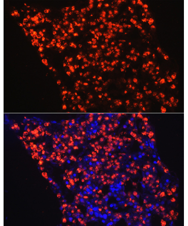 Myeloperoxidase (MPO) Rabbit Polyclonal Antibody