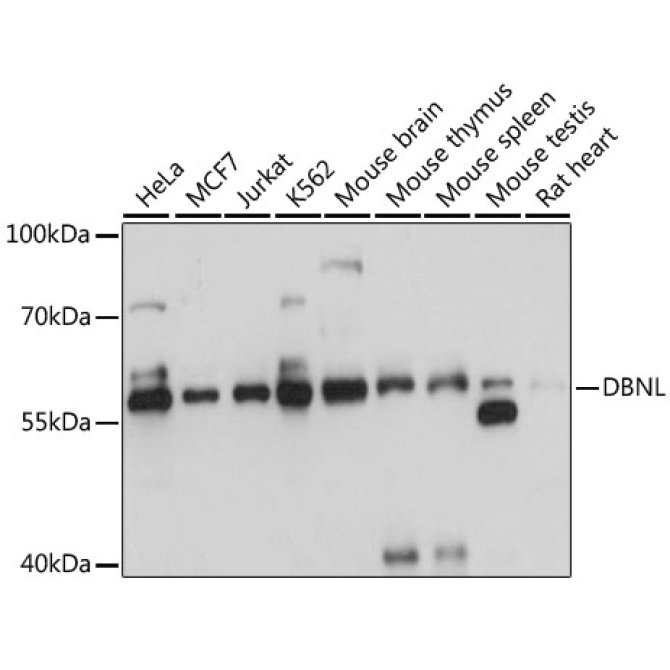 DBNL Rabbit Polyclonal Antibody