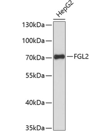 FGL2 Rabbit Polyclonal Antibody