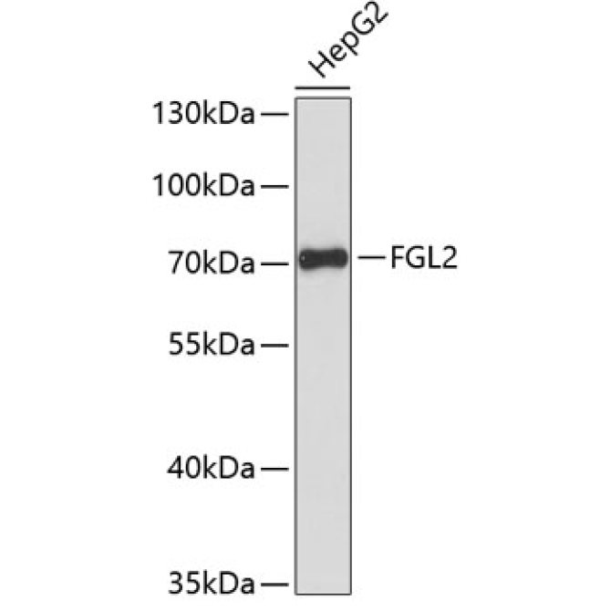 FGL2 Rabbit Polyclonal Antibody