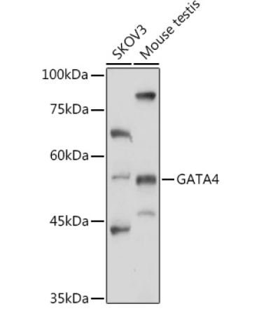 GATA4 Rabbit Polyclonal Antibody