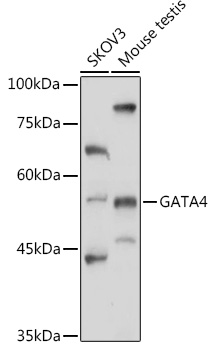 GATA4 Rabbit Polyclonal Antibody