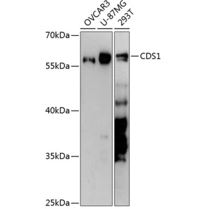 CDS1 Rabbit Polyclonal Antibody