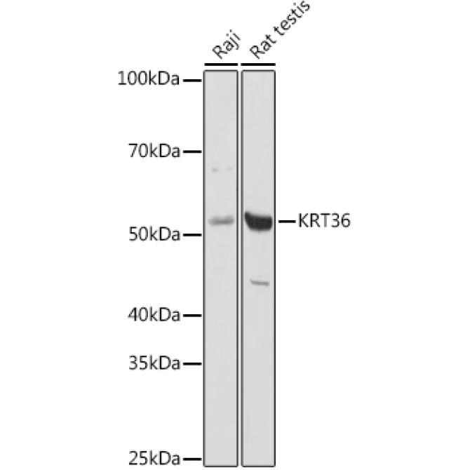 KRT36 Rabbit Polyclonal Antibody