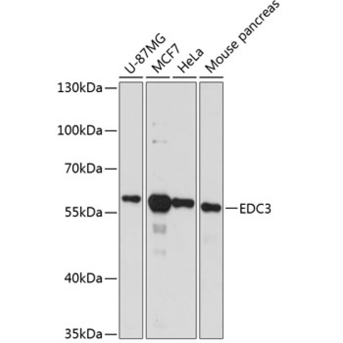 EDC3 Rabbit Polyclonal Antibody