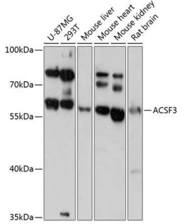 ACSF3 Rabbit Polyclonal Antibody