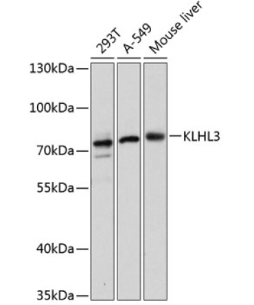 KLHL3 Rabbit Polyclonal Antibody