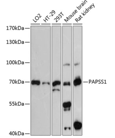 PAPSS1 Rabbit Polyclonal Antibody
