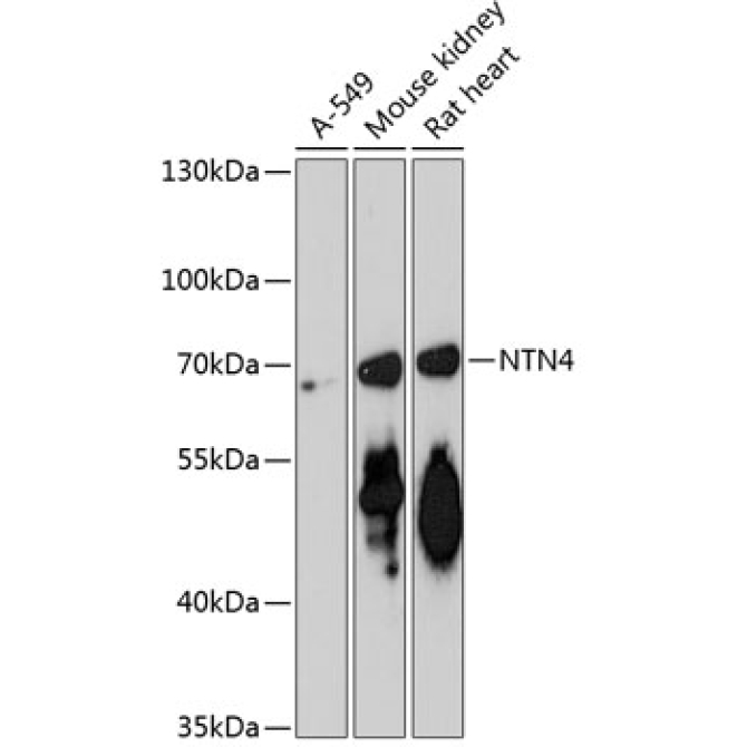 NTN4 Rabbit Polyclonal Antibody