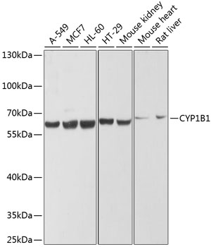 CYP1B1 Rabbit Polyclonal Antibody