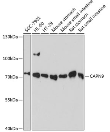 CAPN9 Rabbit Polyclonal Antibody