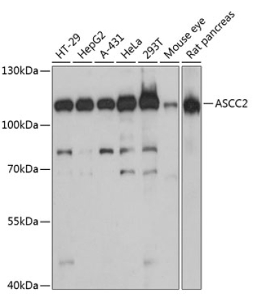 ASCC2 Rabbit Polyclonal Antibody