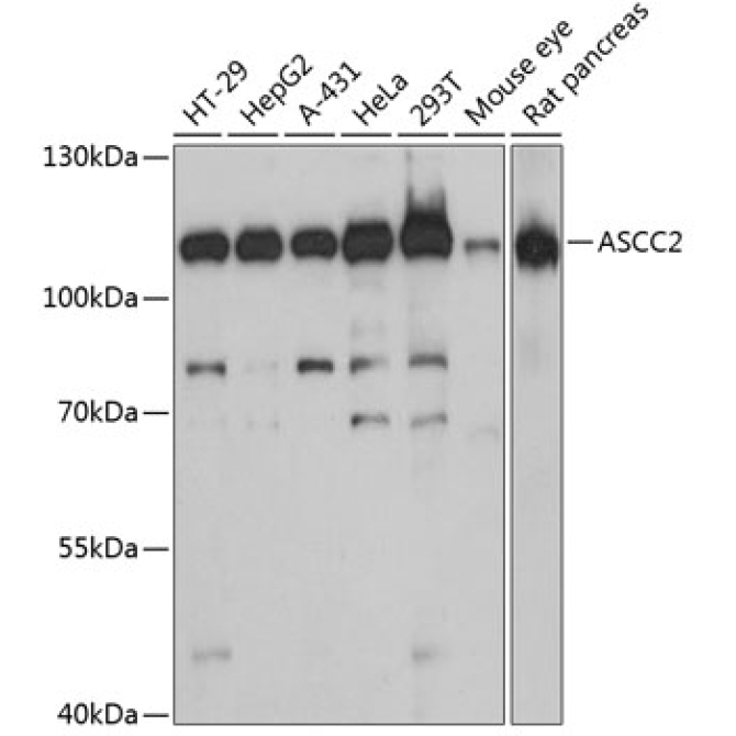 ASCC2 Rabbit Polyclonal Antibody