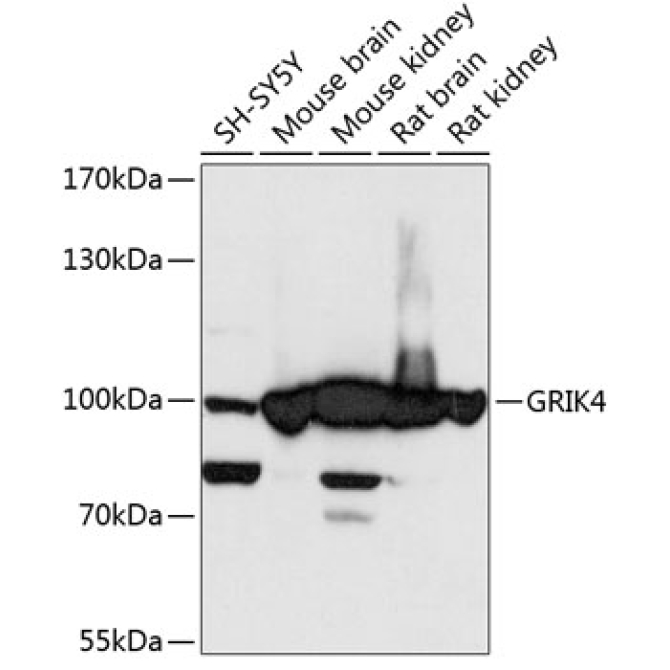 GRIK4 Rabbit Polyclonal Antibody