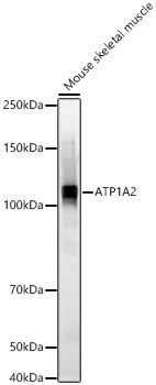 ATP1A2 Rabbit Polyclonal Antibody