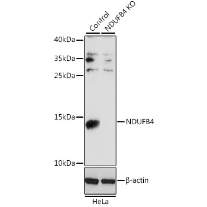 NDUFB4 Rabbit Polyclonal Antibody [KO Validated]