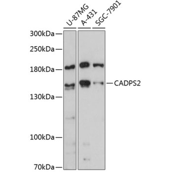 CADPS2 Rabbit Polyclonal Antibody