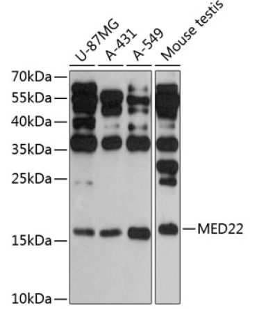MED22 Rabbit Polyclonal Antibody
